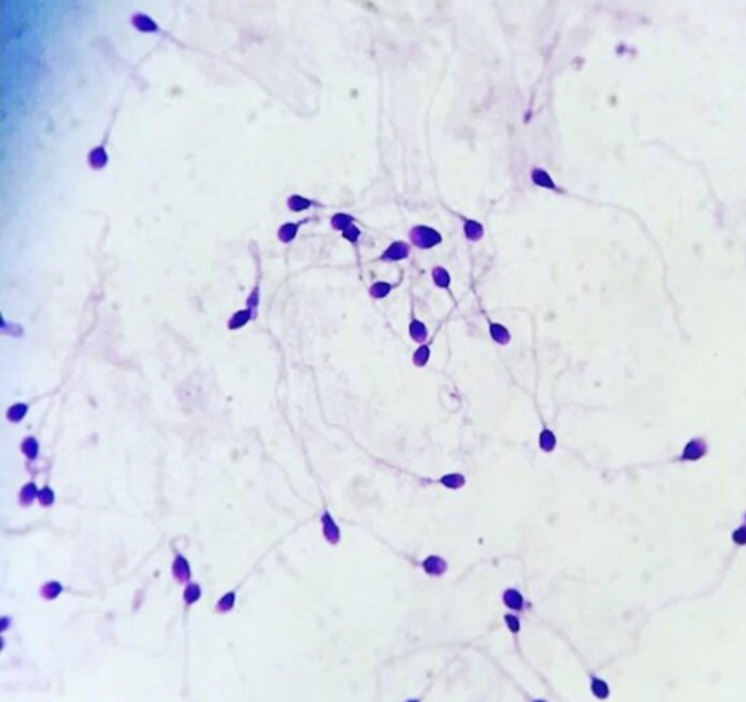 Espermatozoides