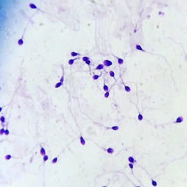 Espermatozoides